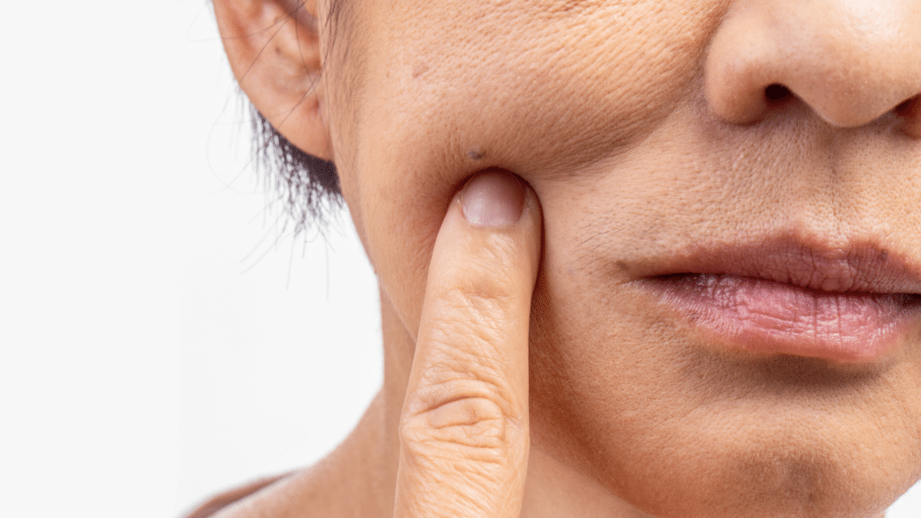 Sculpted or Sagging? How to Fix Ozempic Face & Loose Skin