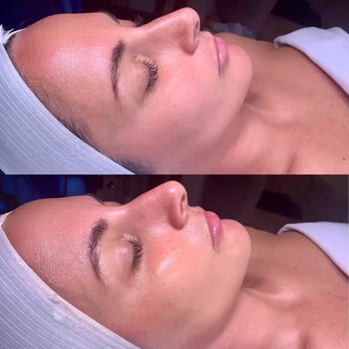 1768248677_7ce38c3121434a299eb352936badcbd5 Hydrafacial