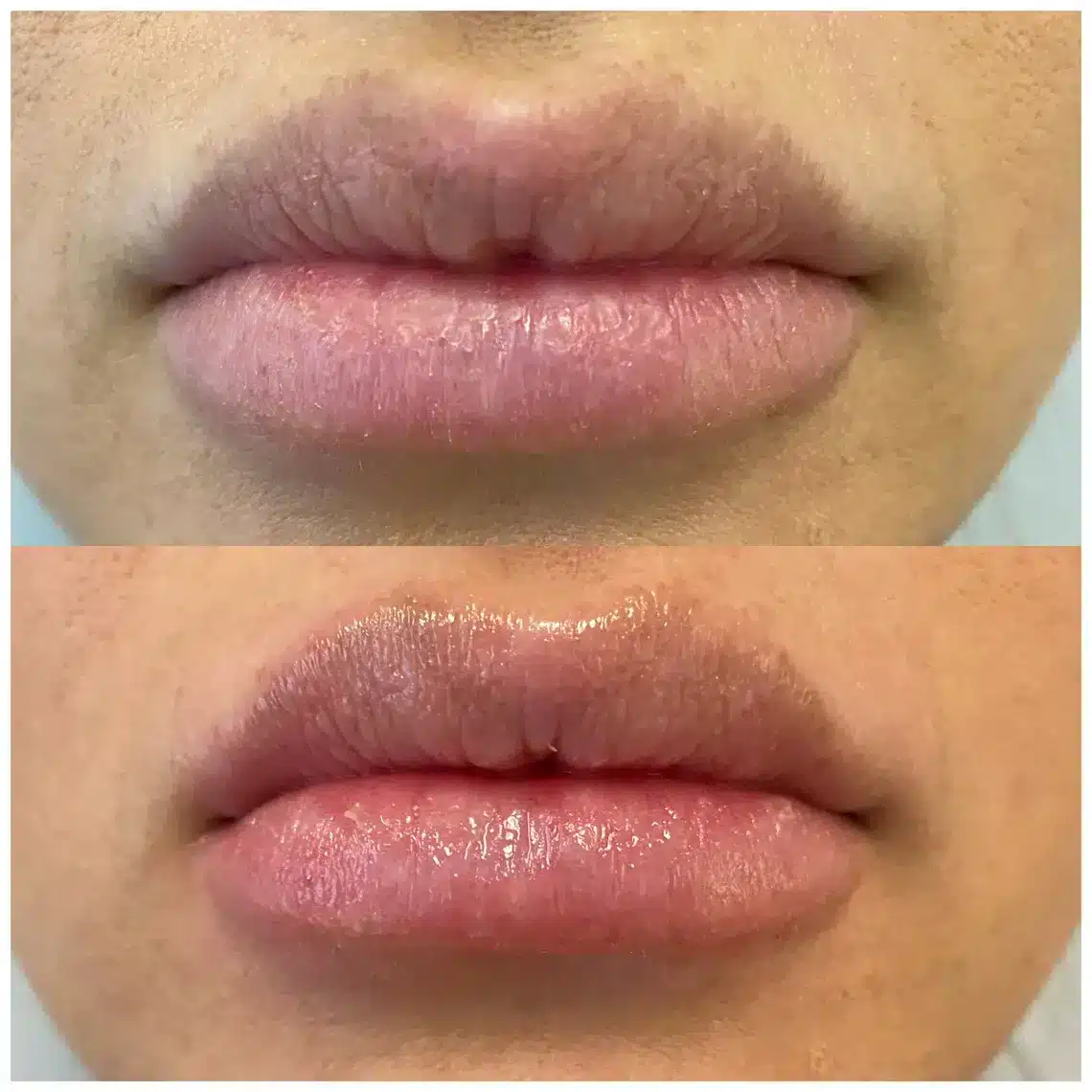 1768248680_07a554b167264fbeb34629d598c14a11 Hydrafacial