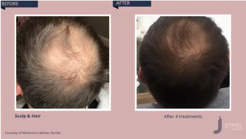 1768248777_2718776db0bd4d3399bbb24707408430