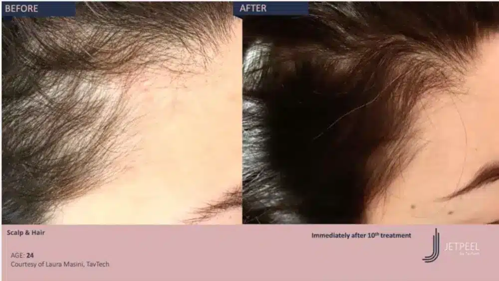 1768248791_91781dfad55948939e14f71a8e82b0c1