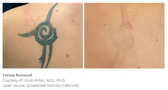 1768248800_2ed0fa2cf298462482cb1d820e30a015