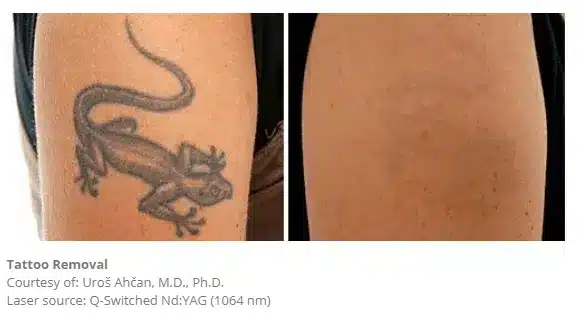 1768248803_b7c60e6a6435414f8e976ed922b84611