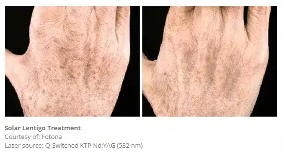 1768248828_0b9009c20fc2456c8c175cc5728020bc