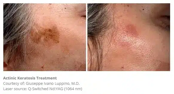 1768248832_fb1b1fd4f3654513b367cfc61ccc6928