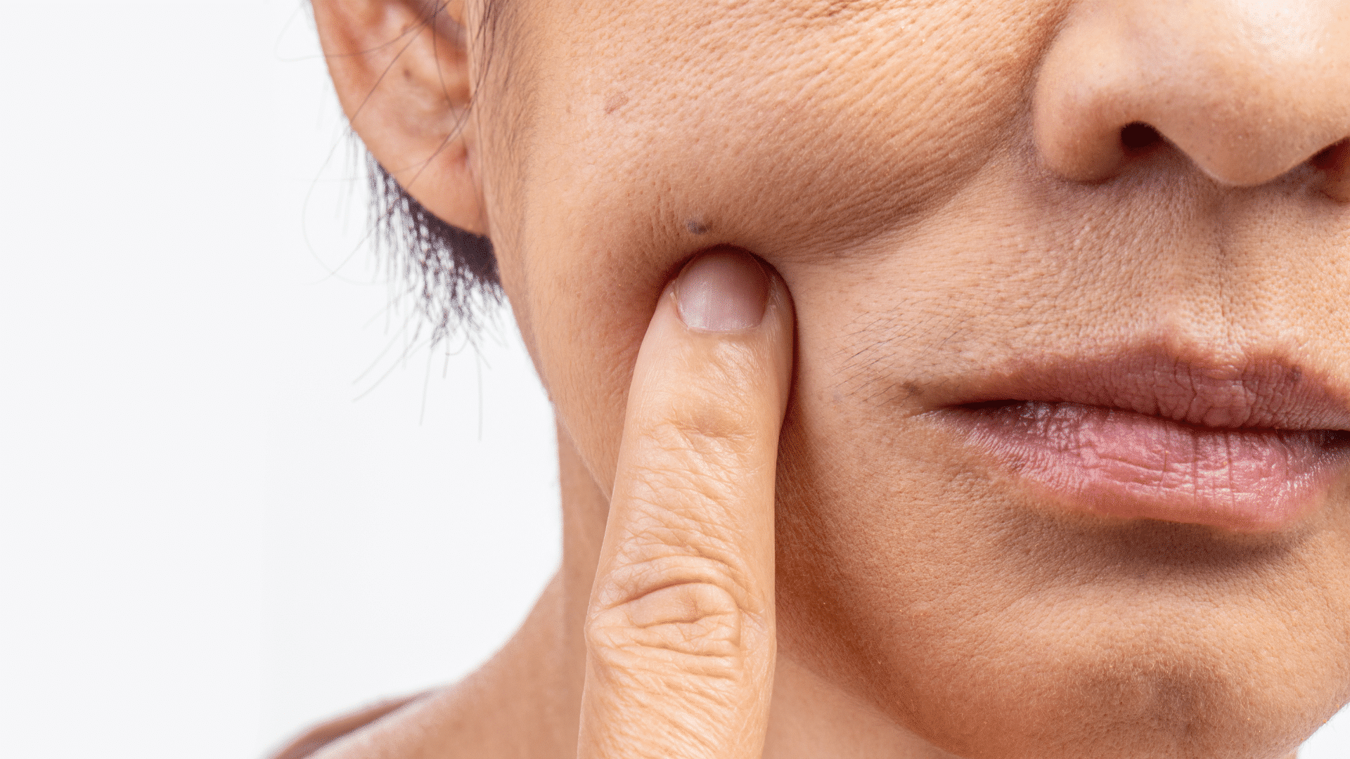 Sculpted or Sagging? How to Fix Ozempic Face & Loose Skin