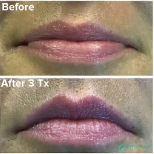 674613be192e66c734712181_optimized_1140Edit