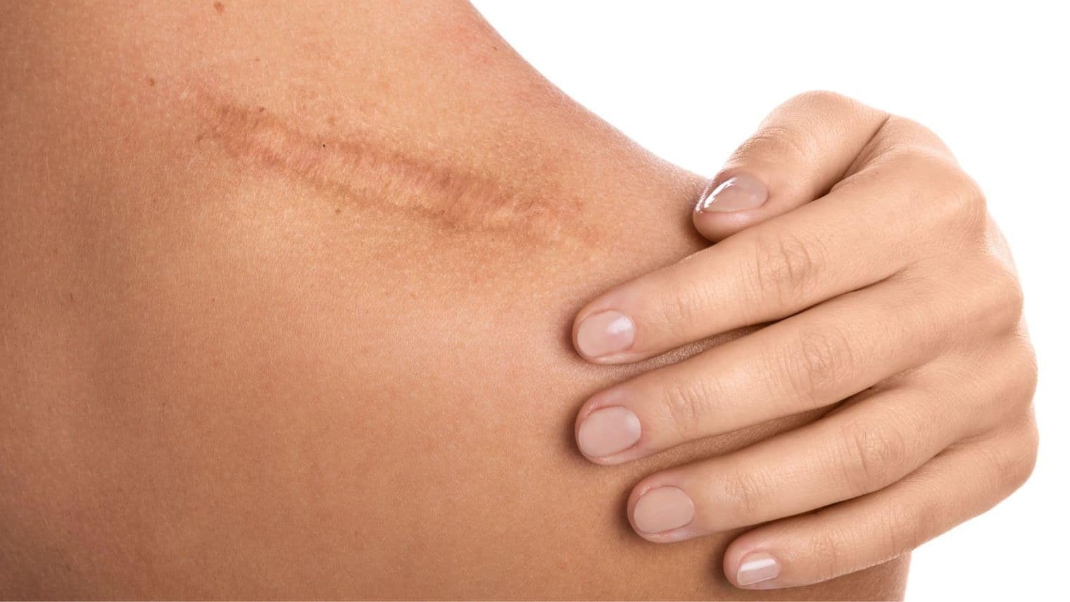 67463c95771aa9bc0f7e72d5_optimized_1520_c1520x855-0x0 Cosmetic Services