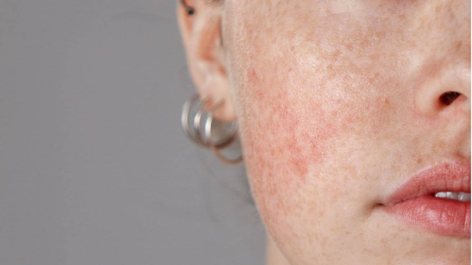 67465484a387fbf33f536d04_optimized_1520_c1520x855-0x0 Cosmetic Services