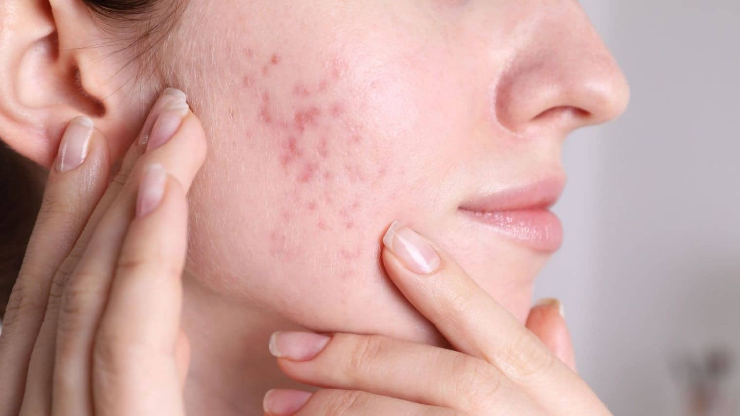 6746550e192e66c73471e00c_optimized_1520_c1520x855-0x0 Cosmetic Services