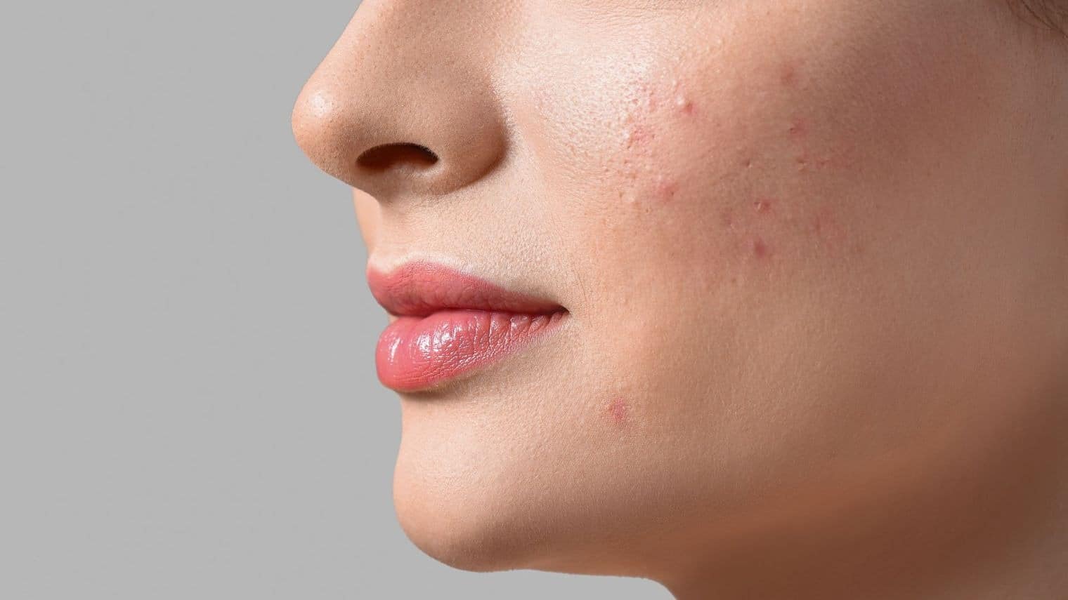 67474572a387fbf33f55aac2_optimized_1520_c1520x855-0x0 Cosmetic Services